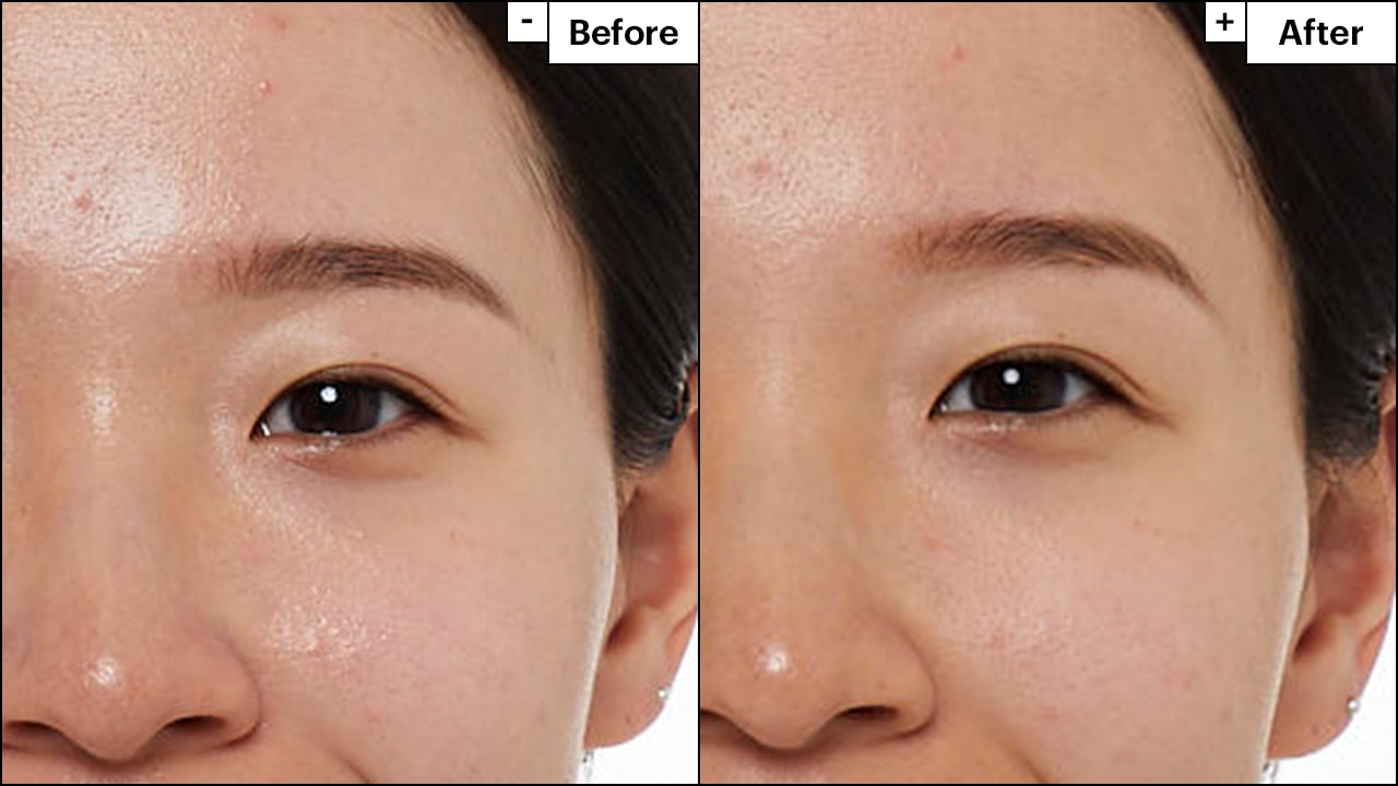 Before and after images show oily skin that is smooth and matte