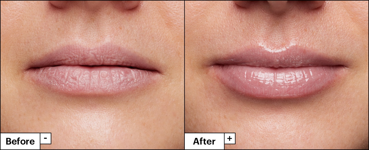 Image of model's lips shows transformative impact of lip mask, revealing dry lips before, and plump, shiny hydrated lips after